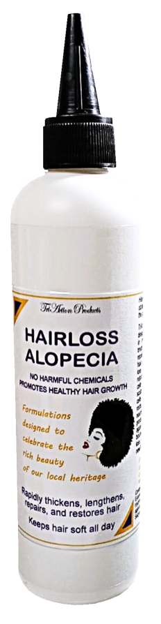 Hairloss Alopecia Treatment